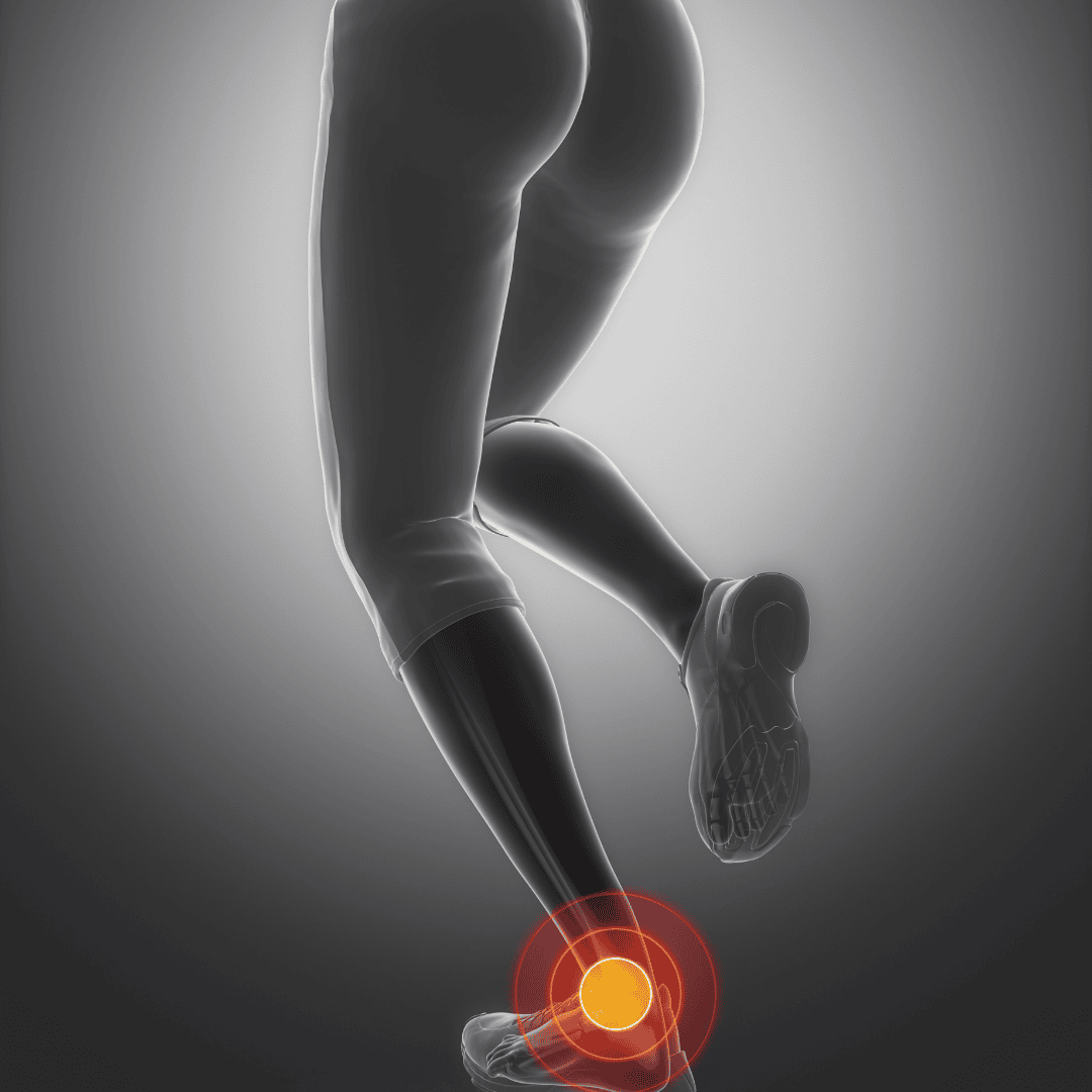 Physiotherapie für den Fuß