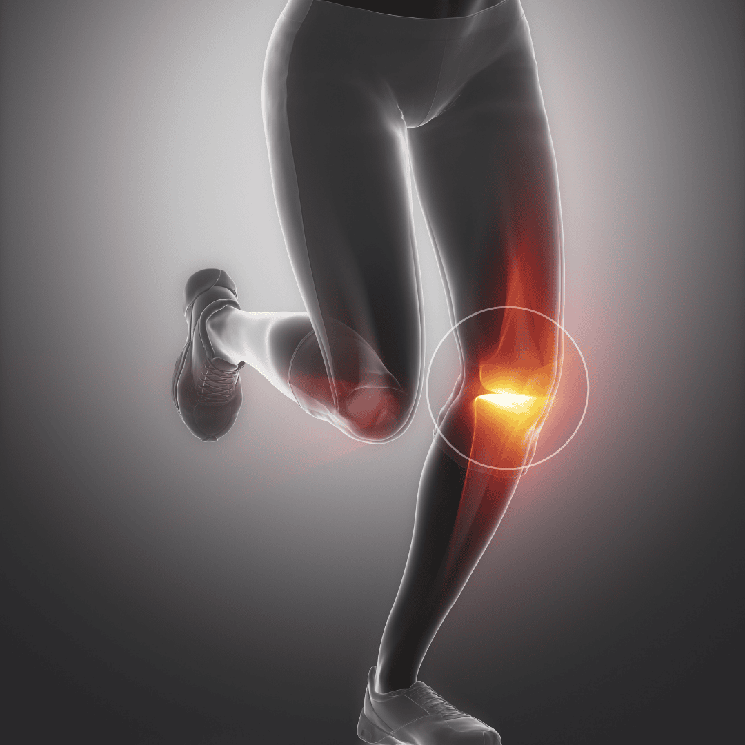 Physiotherapie für das Knie