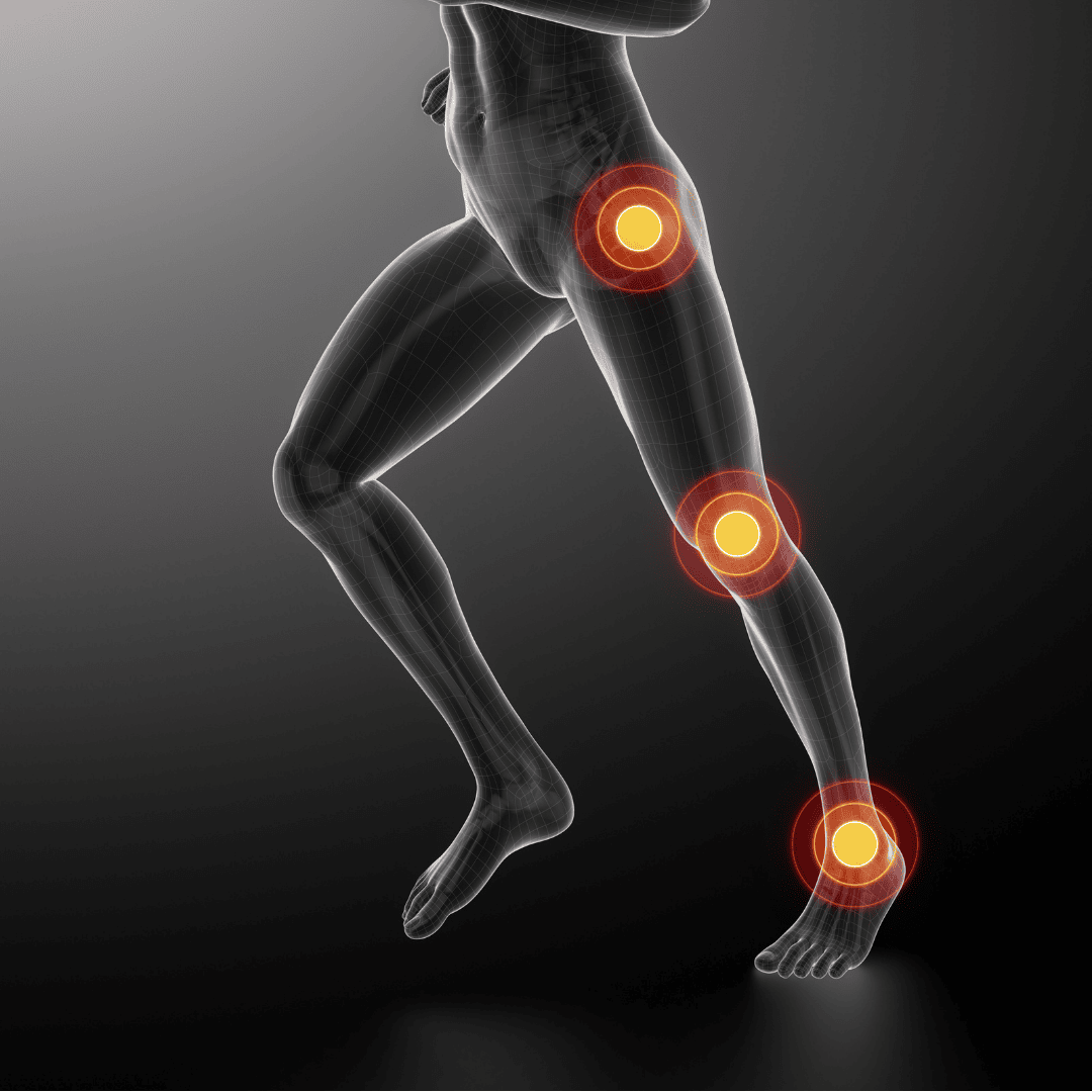 Physiotherapie bei Knorpelschaden & Arthrose