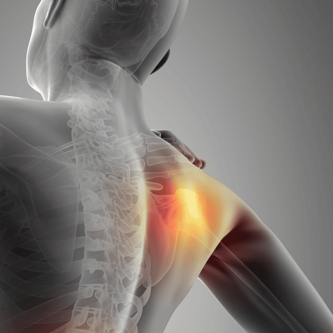 Physiotherapie für die Schulter